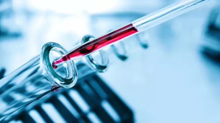 Kedilerde HCT (Hematokrit) Artışı ve Azalışı