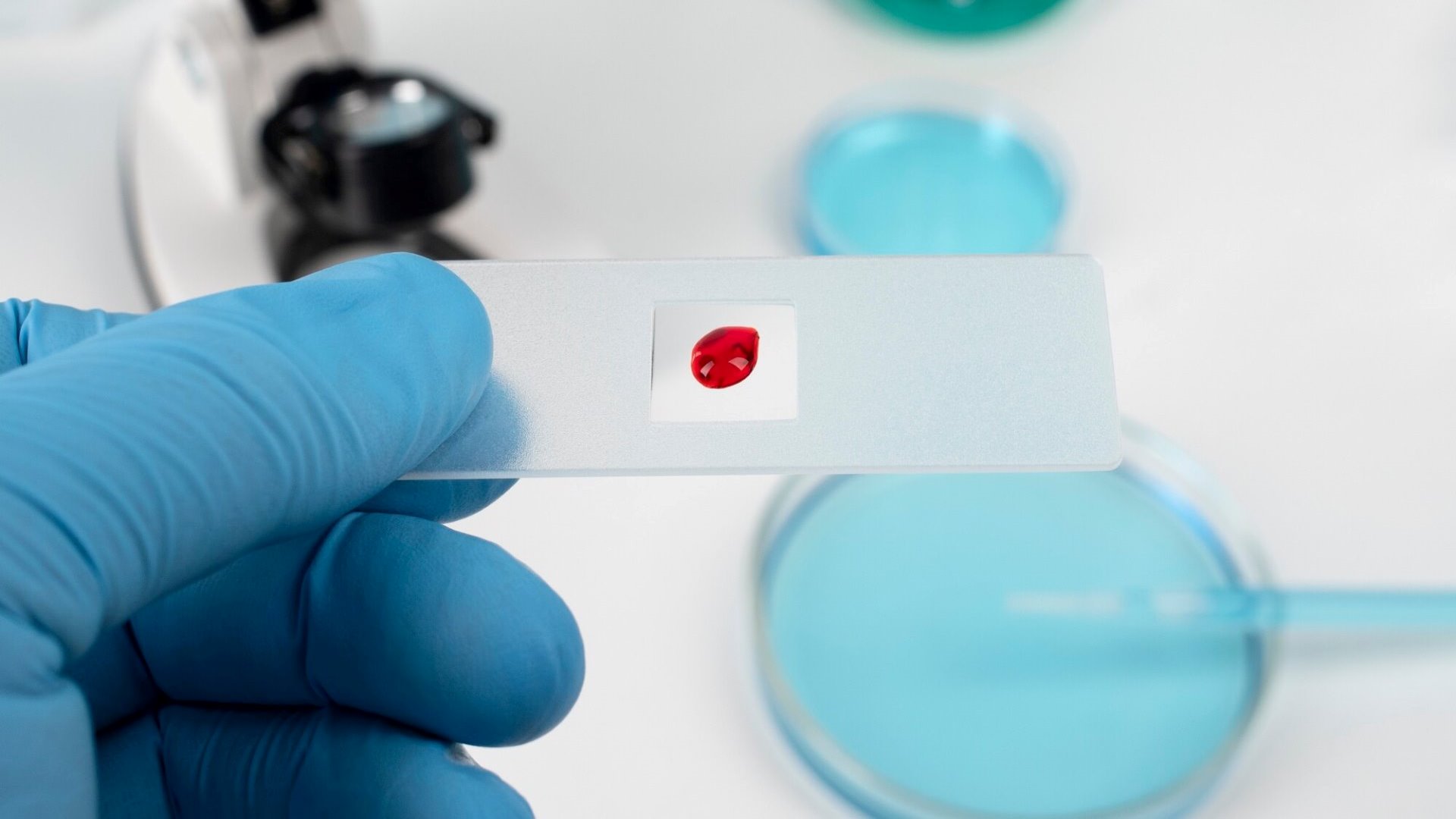 Kedilerde PDW (Platelet Dağılım Genişliği) Yüksekliği ve Düşüklüğü